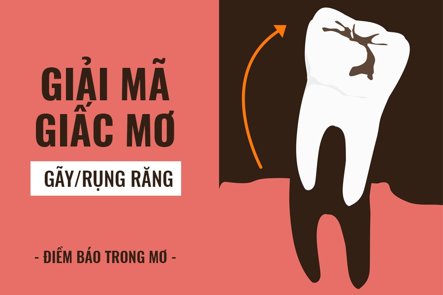 mơ thấy rụng nhiều răng
